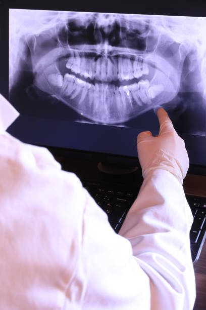 Best Emergency Tooth Extraction in Hillsville, VA